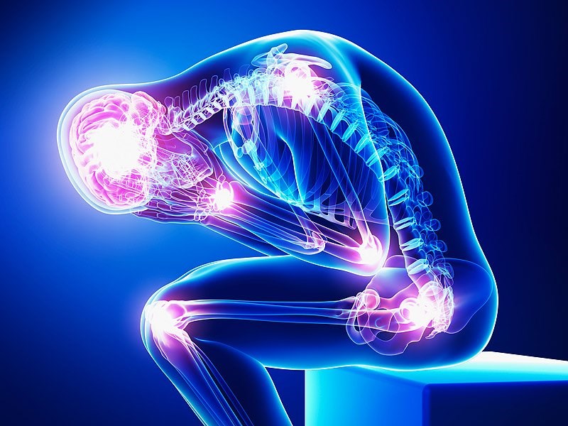 Graphic illustration to depicting chronic pain in adults.